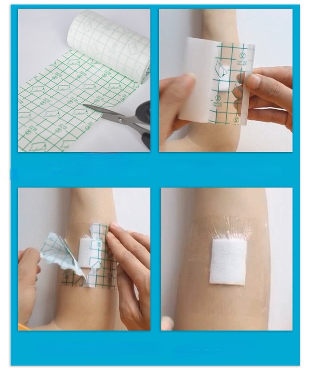 100Pcs Waterproof Transparent Tape PU Film Medical Adhesive Plaster Anti-allergic Wound